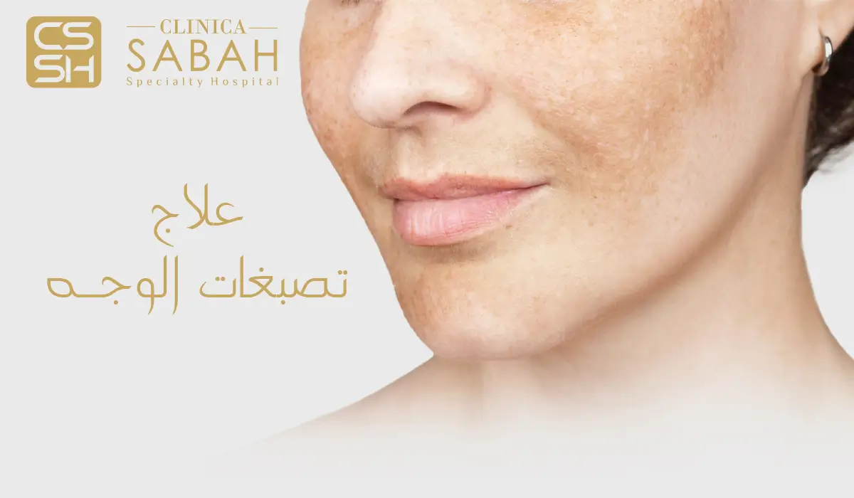 علاج تصبغات الوجه