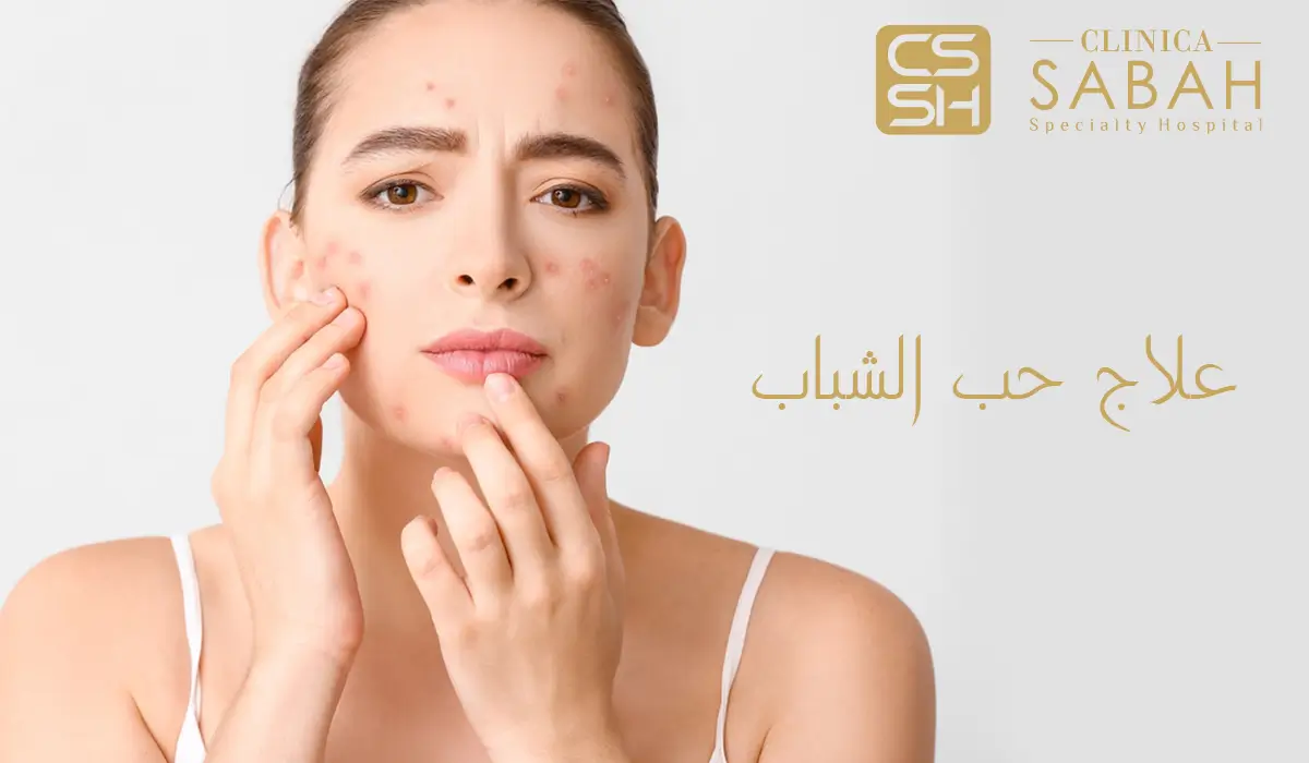 علاج حب الشباب