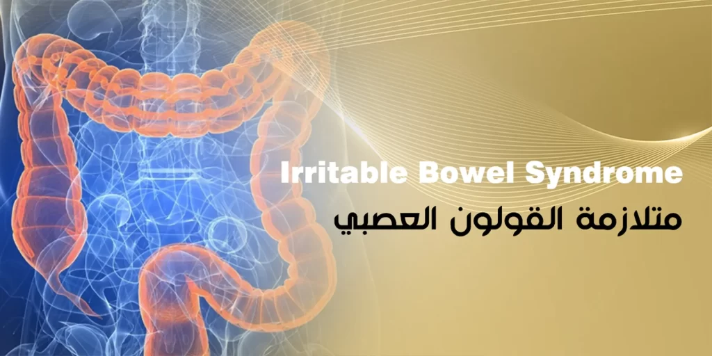 متلازمة القولون العصبي