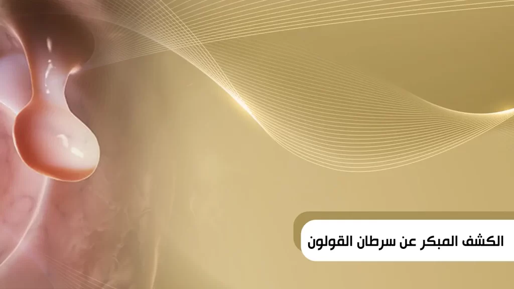 الكشف المبكر عن سرطان القولون