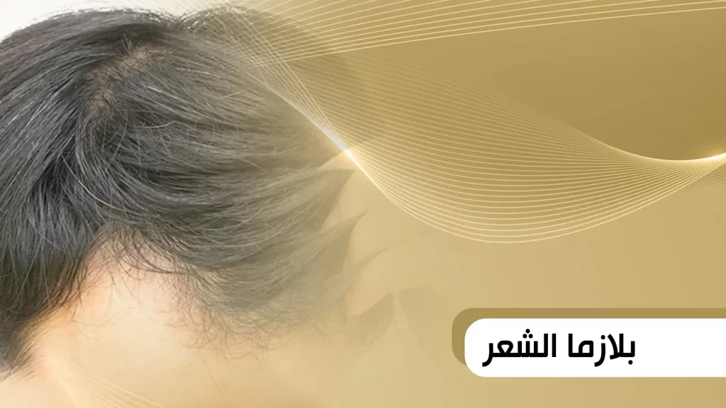 بلازما للشعر