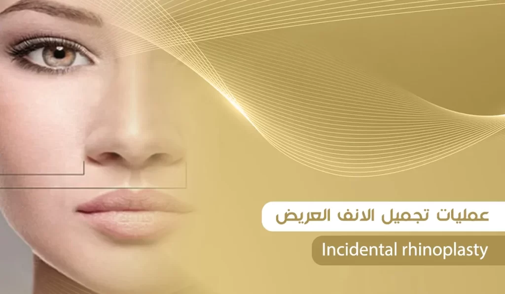 عمليات تجميل الانف العريض