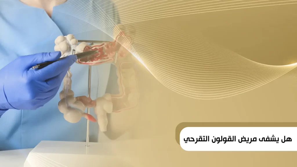 هل يشفى مريض القولون التقرحي