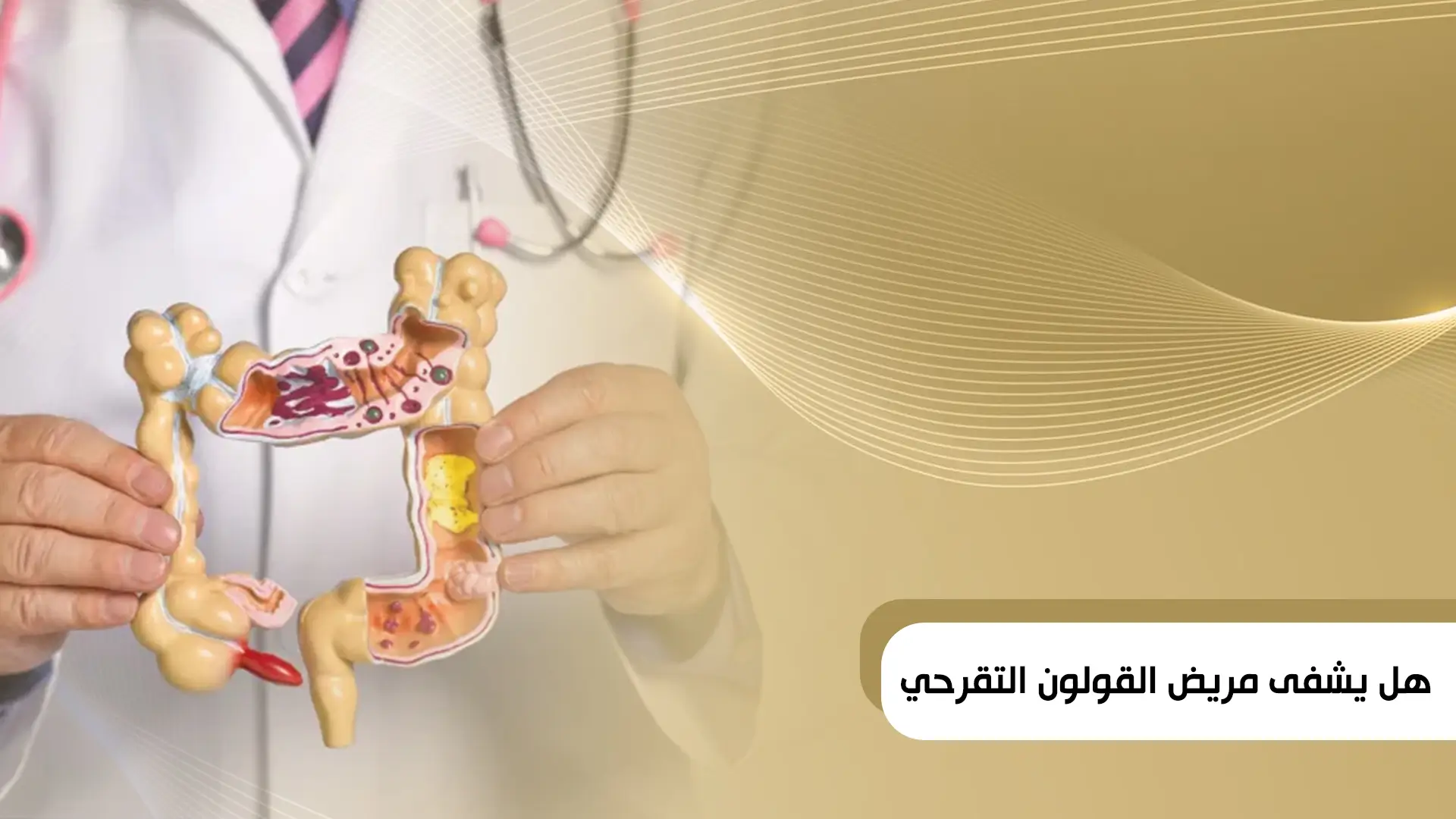 هل يشفى مريض القولون التقرحي