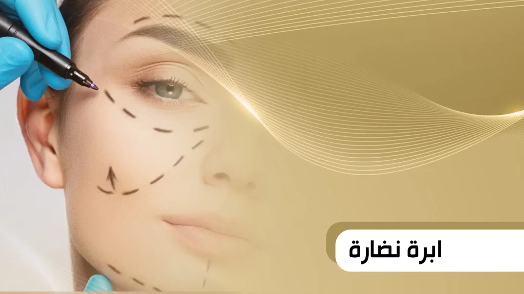 ابرة النضارة