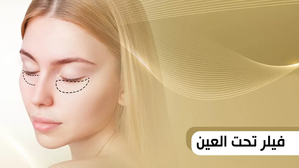 فيلر تحت العين